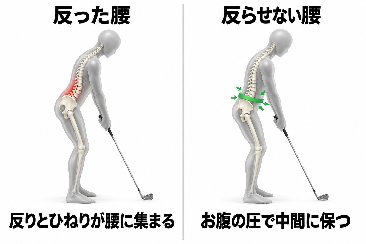 腰を反らせた構えでは反りとひねりが腰に集まり、お腹の圧で腰を中間の位置に保つ構えでは腰が守られることを示す比較図